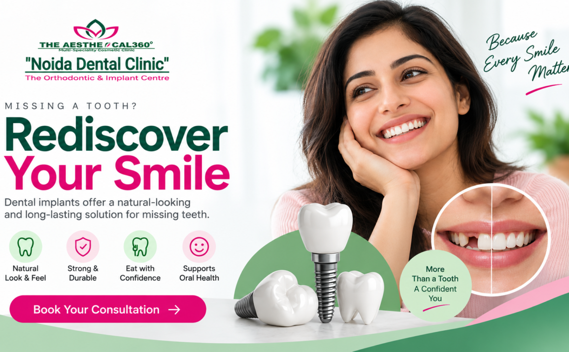 How to Find a Dental Implant Clinic in Noida for Your Treatment Needs