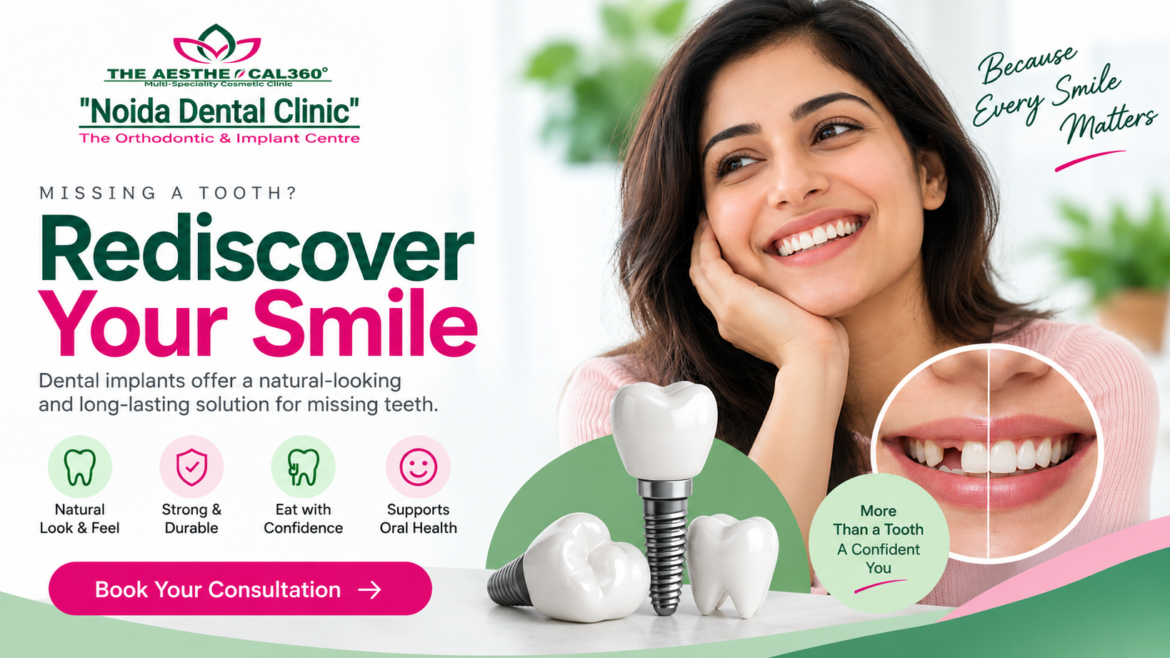 How to Find a Dental Implant Clinic in Noida for Your Treatment Needs